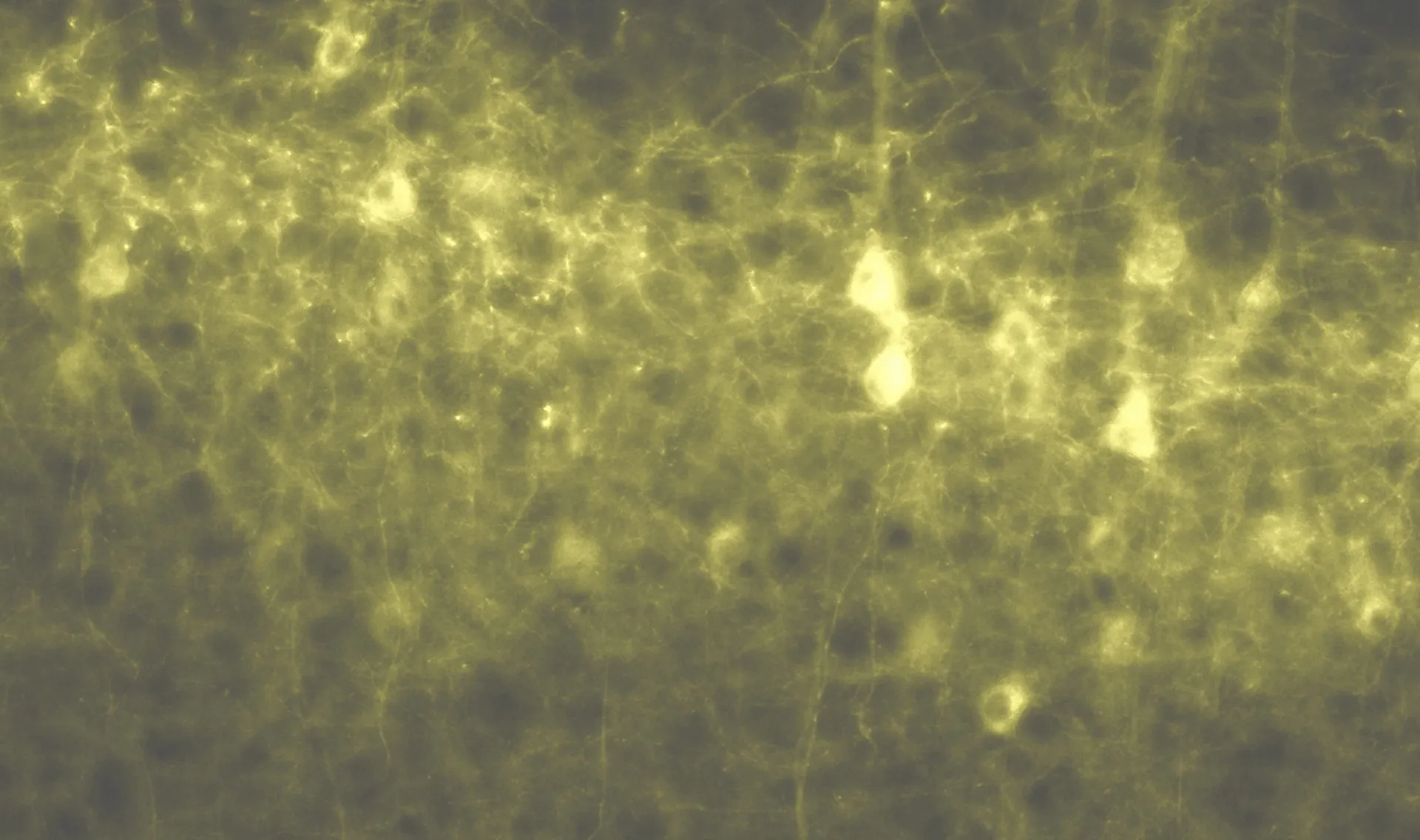 Pyramidal neurons – the source of mammalian cognition? 
